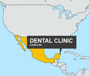 Dental Clinic in Cancun